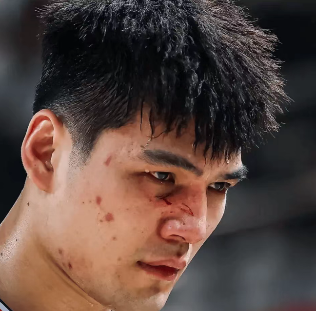 伤痕明显!广州状元陈国豪面部骨裂 季后赛大概率戴面具对阵广东