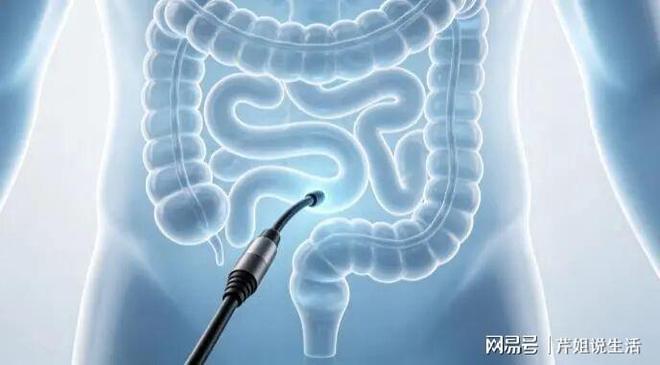 非必要不做肠镜？医生：只要做过肠镜，患者一定多加关注这4点！